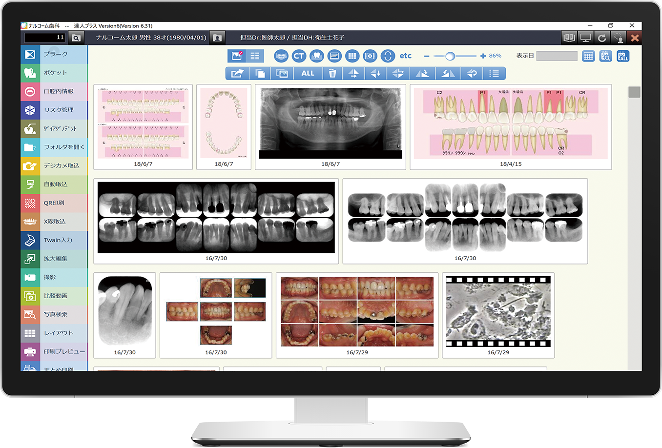 達人プラスversion6 歯科医院用患者管理支援ソフト 歯周検査 画像 動画管理